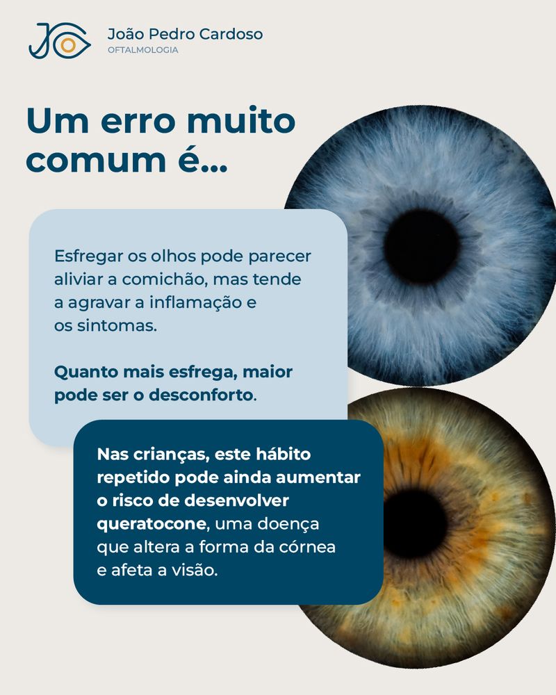 Publicação sobre o erro de esfregar os olhos e o risco de agravar a inflamação e de desenvolver queratocone
