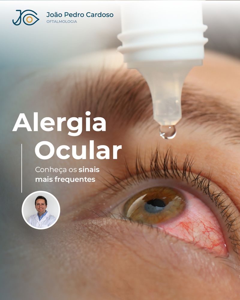 Publicação de abertura sobre alergia ocular, com um colírio a ser aplicado num olho irritado